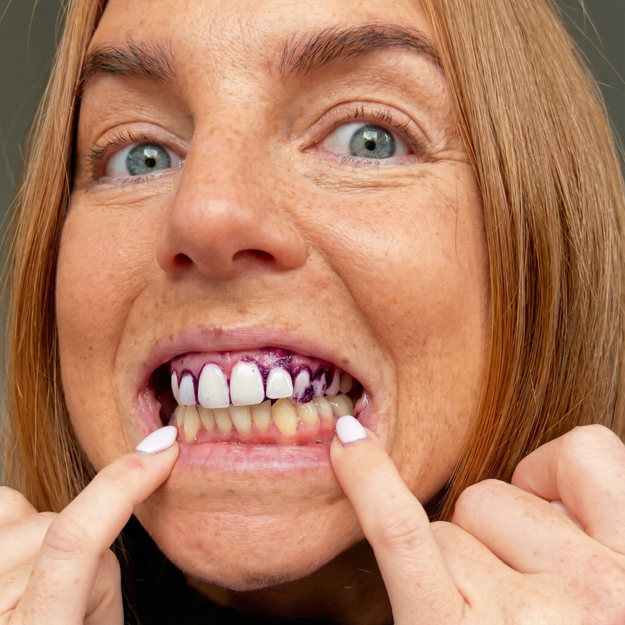 Blekningsremsor – Ett Självsäkert Leende